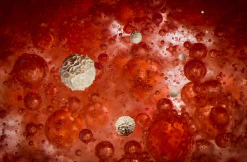 高血脂“根源”已找出，并非肥肉，医生：常吃“1酸”等于“自毁血管”