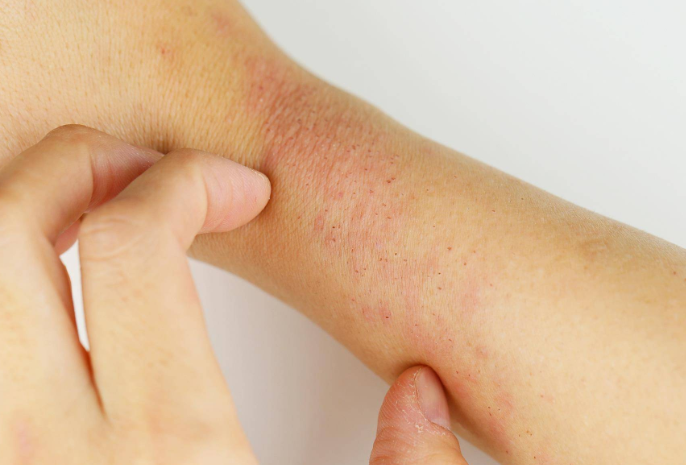 大蒜|再三忠告:身体2处“发痒”,别误以为过敏,或是肾衰“造访”,需警惕