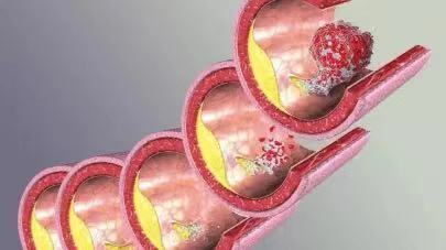 抑郁症|都21世纪了，还有人觉得老烂腿保不住，要“锯腿”？