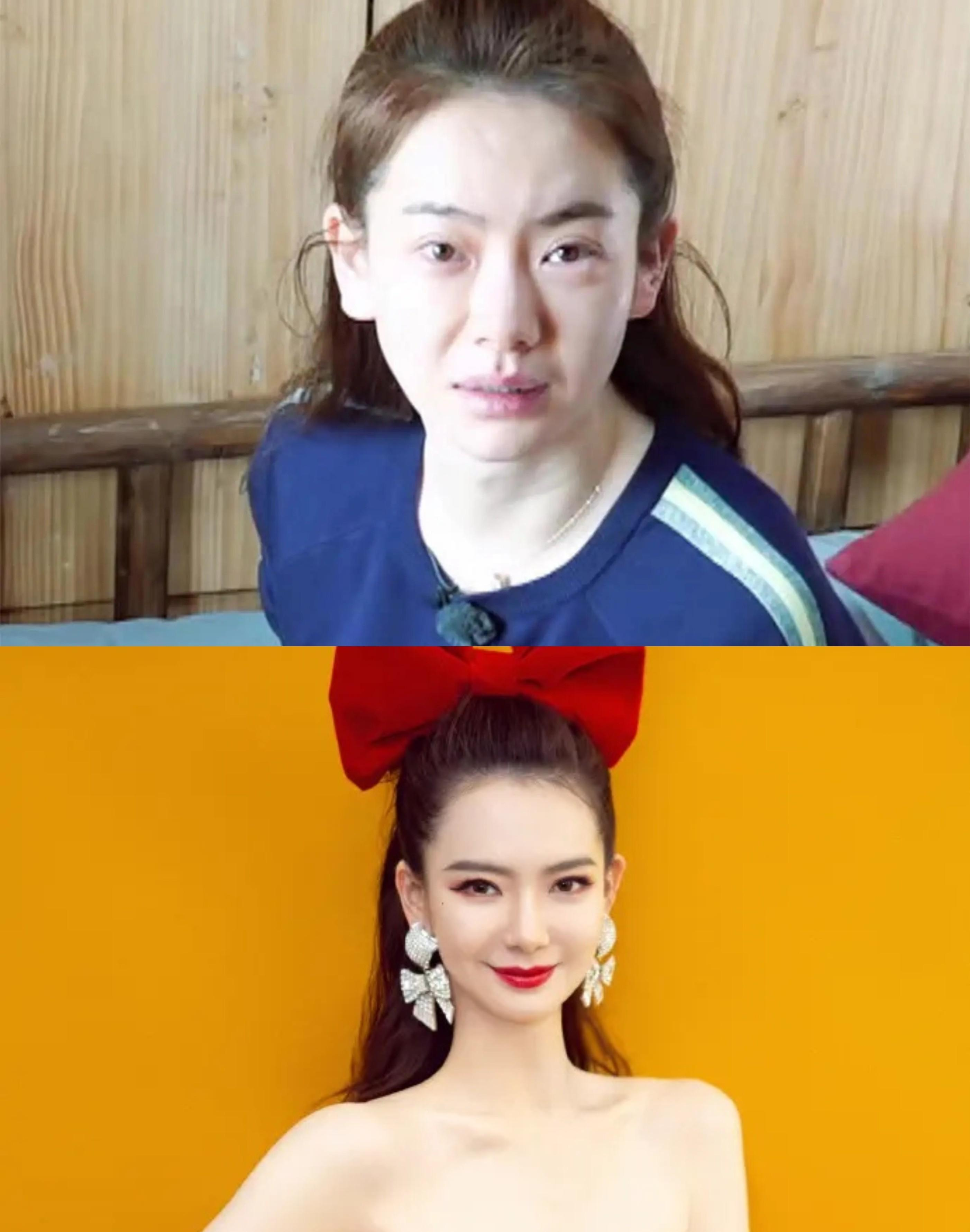 明星|假牙假胸假屁股，内娱“从头假到脚”，原来没有什么是真的