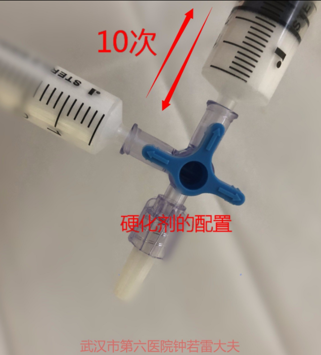 静脉曲张|深度分析-----如何选择最“好”的静脉曲张手术?