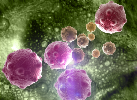 致癌物|小心！身上的肥肉不仅让你提前变笨，还会升高患癌症的风险