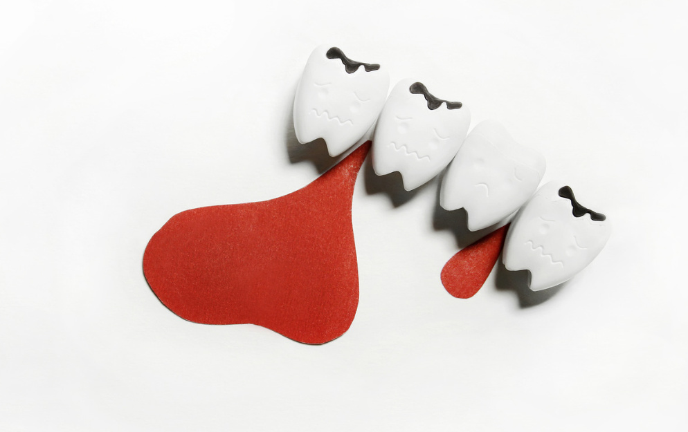 老年病|牙龈出血、口气难闻为何“形影不离”?中医与“胃火旺盛”有关,一个方法可解!