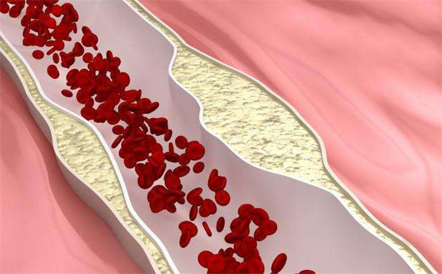 地黄|人到中年血液粘稠,莫慌!多吃此菜,血管畅通无阻,早吃早健康!