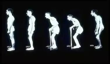 李宇春|李宇春被曝得“不死之身”中国四百万年轻人患病