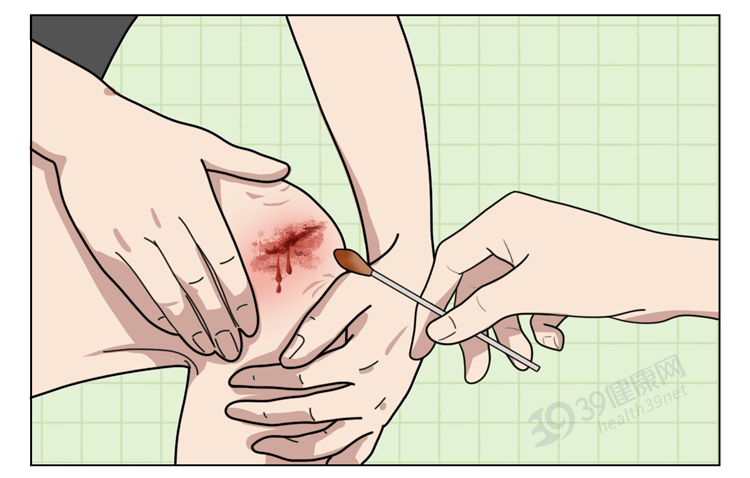 长寿|艾滋病“后悔药”你了解吗?高危行为后,及时服用或能救你一命