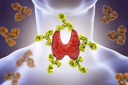 银耳|90后夫妻双双确诊甲状腺癌，医生：炒菜总放它，刺激甲状腺肿瘤增长