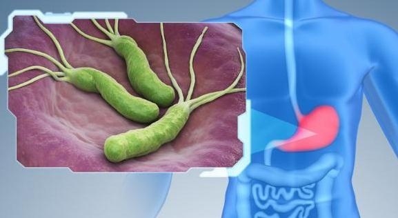 幽门螺杆菌|幽门螺杆菌“克星”被找到！医生：1物当零嘴敞开吃，胃或慢慢变强壮