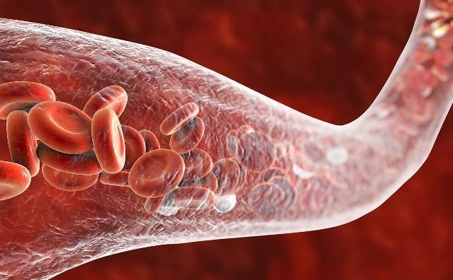 穴位|“血稠”最怕这8种好习惯,坚持一年以上,血管畅通无阻