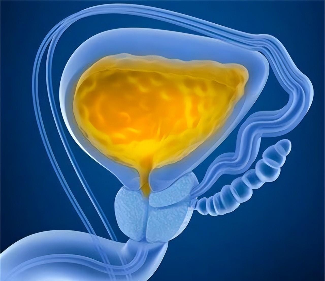 前列腺炎|男人如何保养好前列腺?4件事引来“前列腺炎”,懂的人都不会碰