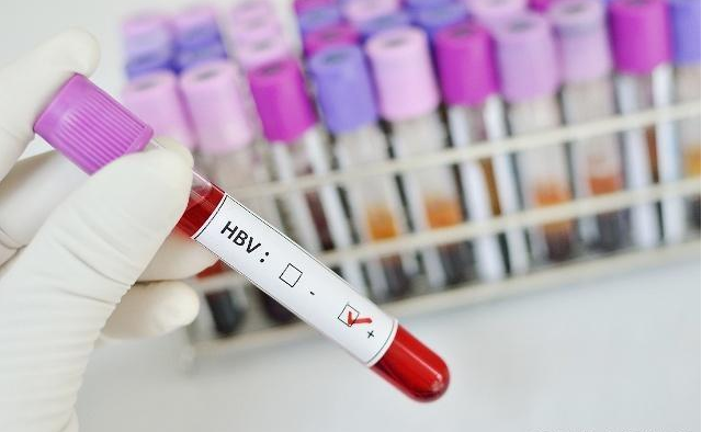 内科|乙肝病人“守住”5个生活原则,治疗时可少走弯路