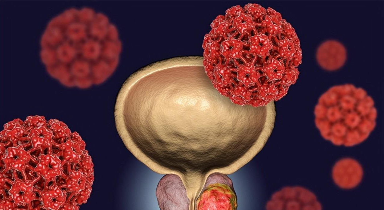 前列腺炎|男人如何保养好前列腺?4件事引来“前列腺炎”,懂的人都不会碰