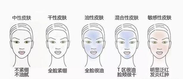祛斑 干性皮肤长色斑怎么办？如何祛斑？是否补水就行？