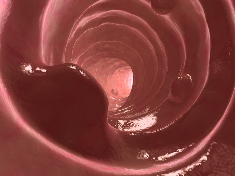 胆结石|癌症并非突然到来,身体出现5种“小病”要重视,或是癌前病变