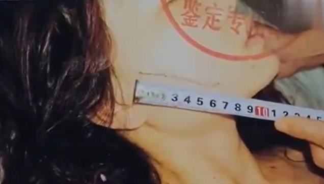 湖南女子上班一夜赚8000元,丈夫看其手机后,连夜将她毁容