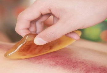 刮痧|刮痧是中医的传统疗法,是否适合癌症患者?