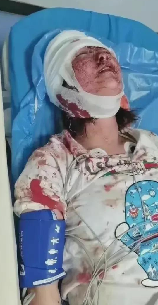 唐人打人主犯陈继志老婆发话:凭什么这样对我和女儿?我们又没错