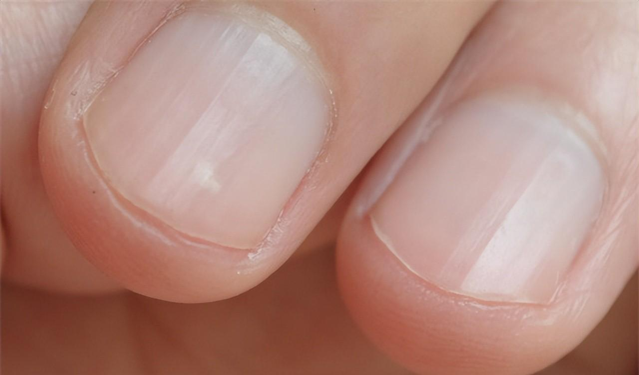 心脏病|为什么胸口会“刺痛”几秒？是心脏病吗？医生科普