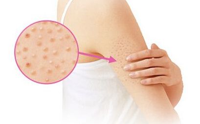 粉底 出现这种情况,可能是“鸡皮肤”,别不当回事