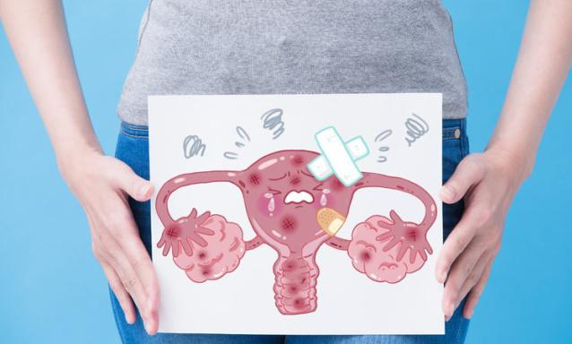 肿瘤|上厕所时发现几个异常,留心,可能是妇科肿瘤的“记号”