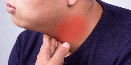 医生|入夏后,喝一次不亚于喝地沟油,消化科医生:少喝点,当心甲状腺癌变