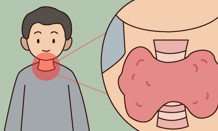 饮食|柳叶刀:中国“饮食杀手”不是油和糖,3种饮食习惯,会摧毁甲状腺