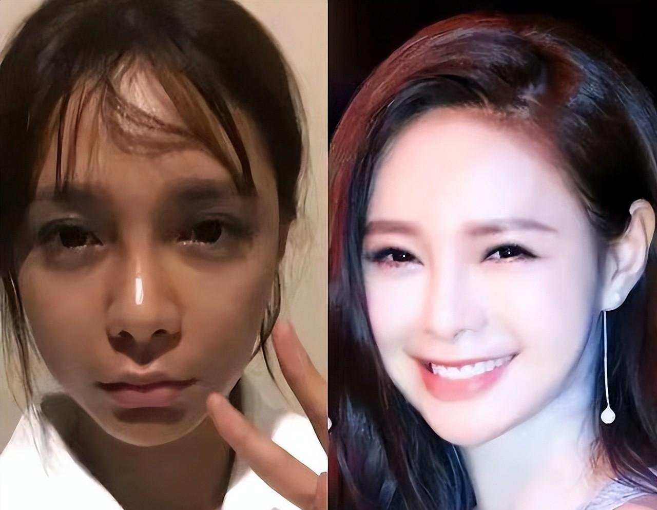 明星|假牙假胸假屁股，内娱“从头假到脚”，原来没有什么是真的