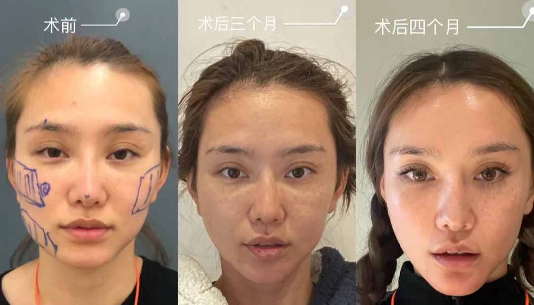 王思聪|王思聪34岁生日爆热搜,却全网翻车被连环嘲?