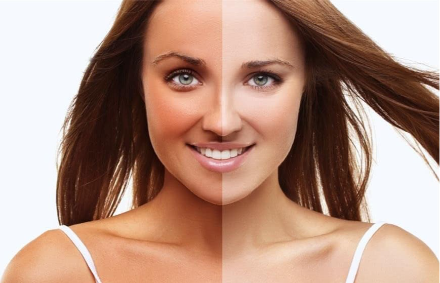 美容 被妮可基德曼白到反光的的皮肤闪到,演吸血鬼都不用化妆 。