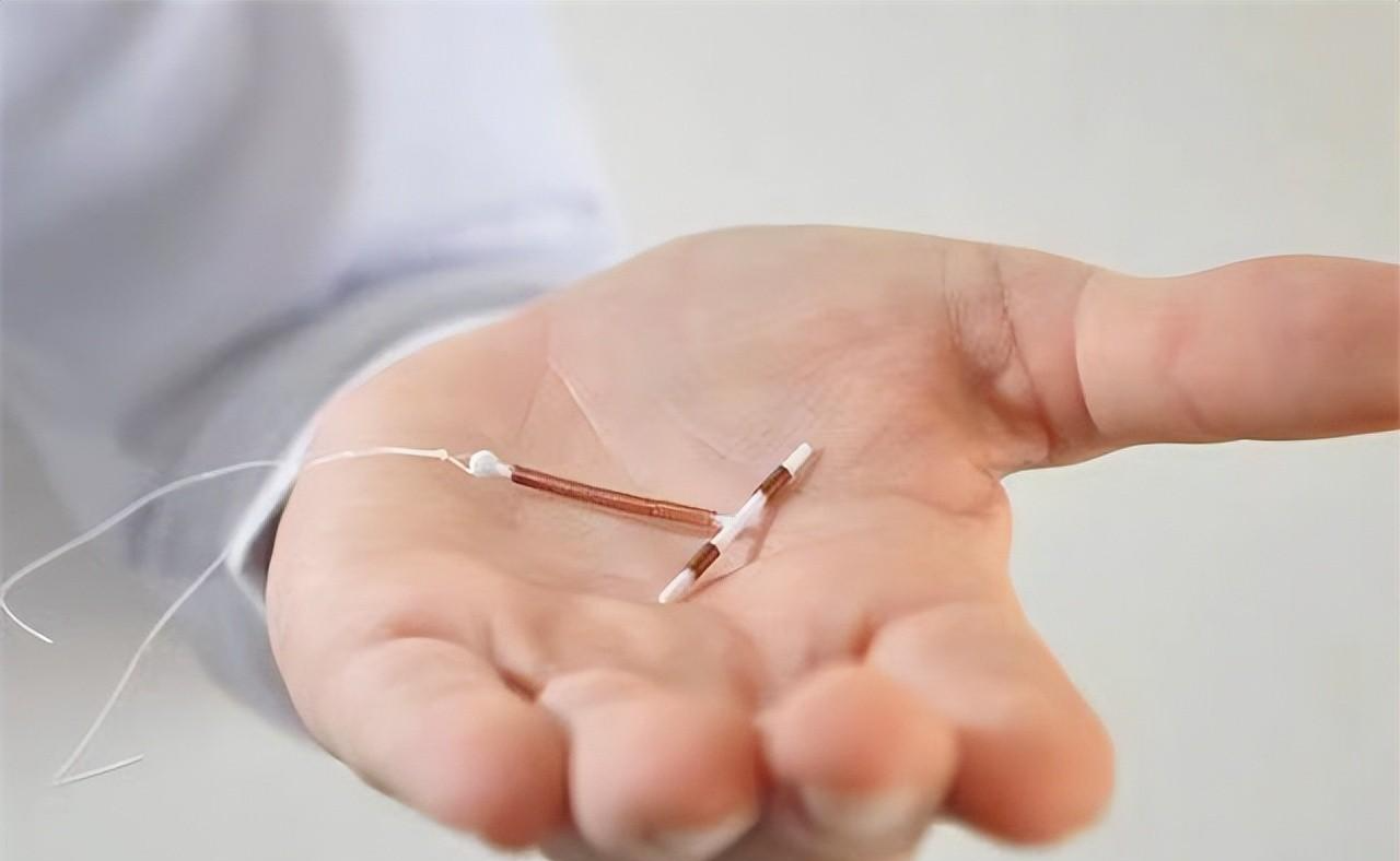 结扎|节育环一直不取出来,会长到肉里吗?在多大年龄之前取出比较好?