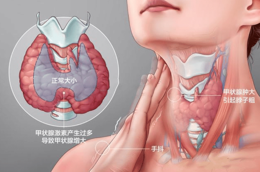 冬瓜|冬瓜和2物同食，堪称“散结王”，结节患者敞开吃，甲状腺会感激你