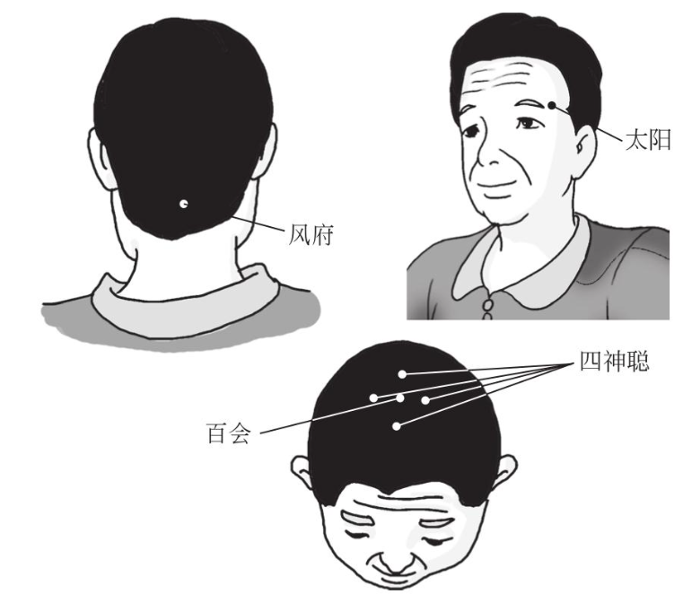 脱发|告别头秃——脱发的中医疗法