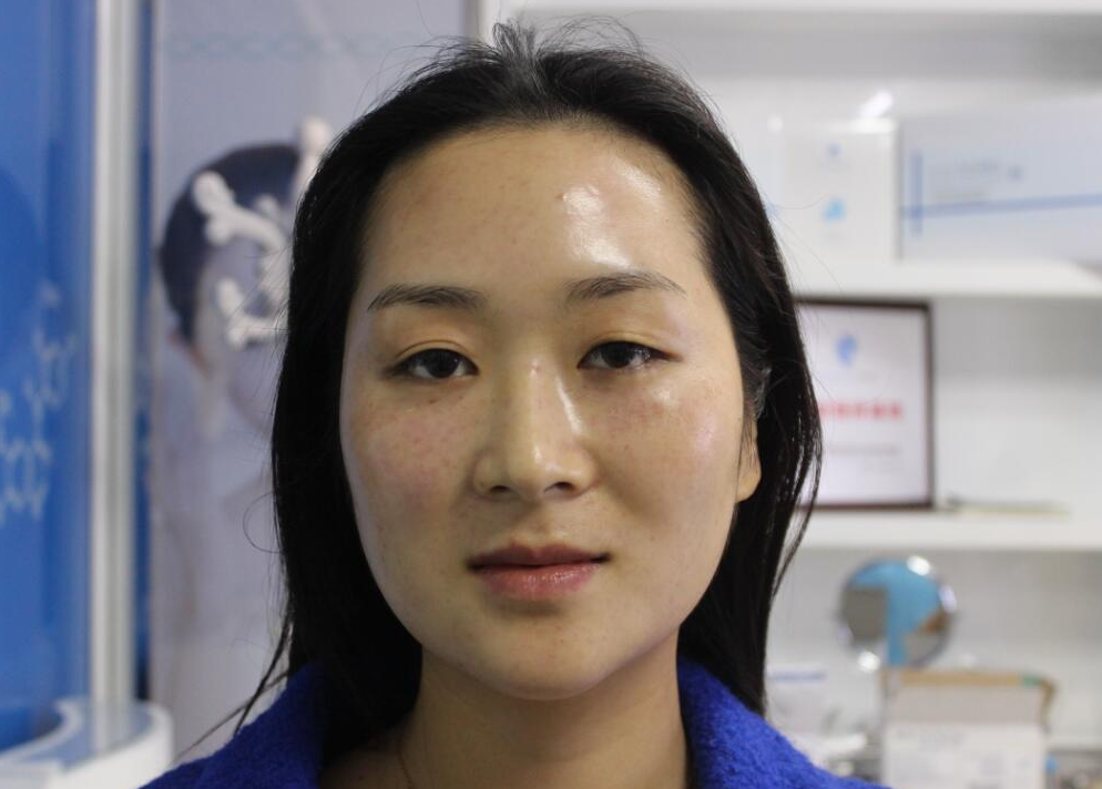 卸妆 中年女人脸色暗黄气色差？坚持养成这几个好习惯，就算老了也耐看 。