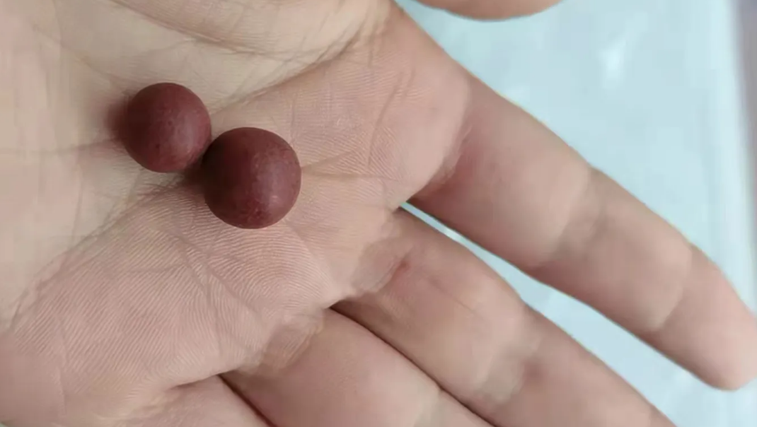 核糖核酸|科普:5种润肠通便的中成药,如你大便干结,毫无便意,不妨看完收藏