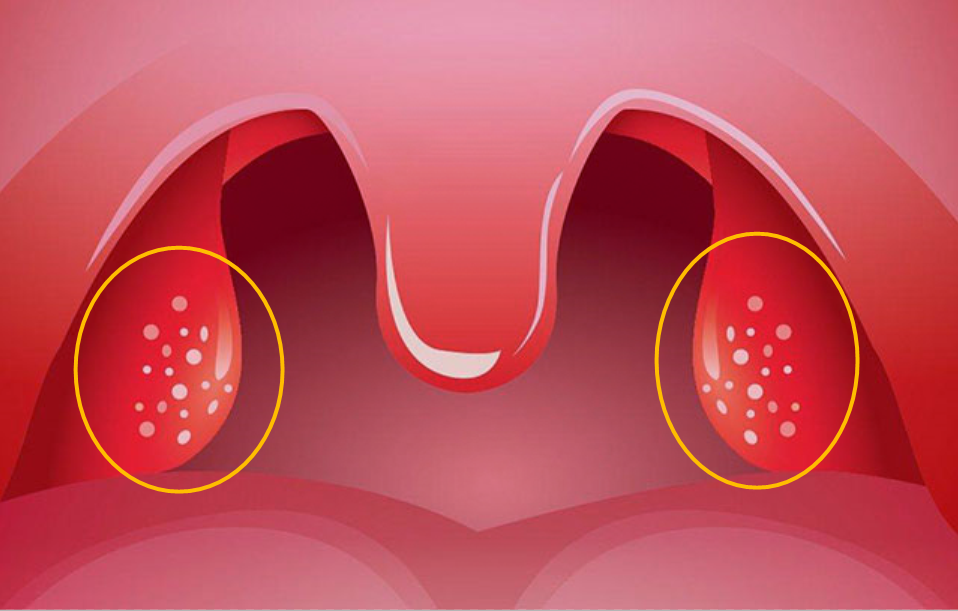 心脏|喉咙不适,要补充哪些营养?提醒:多食用这些食物,或能缓解不适!