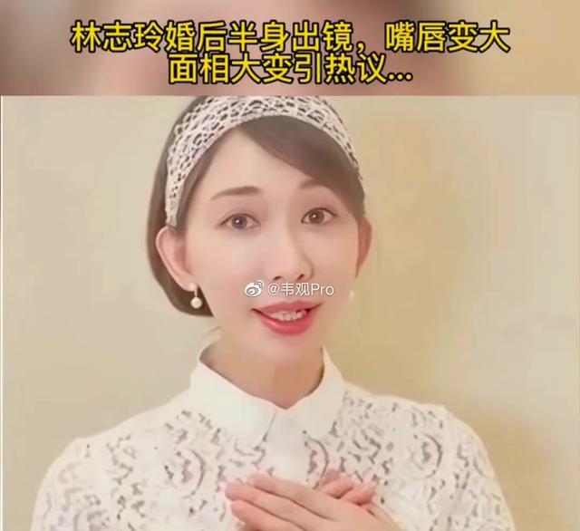 林志玲|林志玲状态好差！嘴变大了，眼神黯淡无光，远嫁日本有什么好的！