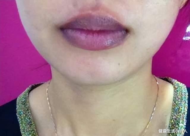 罗汉果|肺脏好不好看得见，多看看这4个地方，肺脏好坏，一目了然