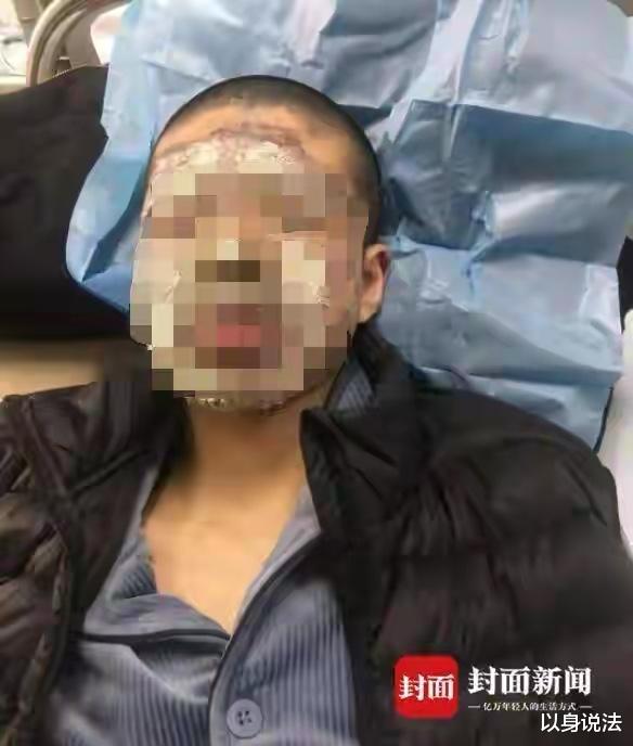湖北武汉,家长在孩子学校表演吐火时被烧伤,该由谁来负责