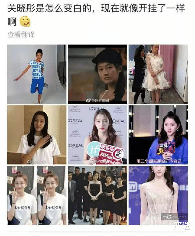唇釉 娱记曝关晓彤定期去打美白针，因身体受到影响，露面都靠全身擦粉