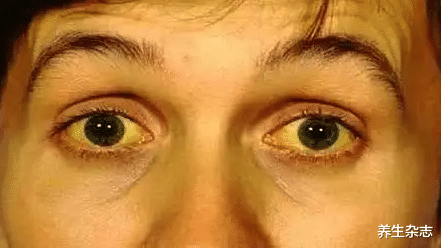 补肾|55岁农民工肝脏癌变,医生:“1粗粮”吃一口等于10斤白酒,趁早扔