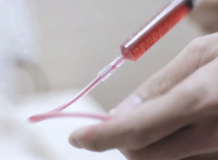 影帝|提名影帝时,他在菜市场管理厕所