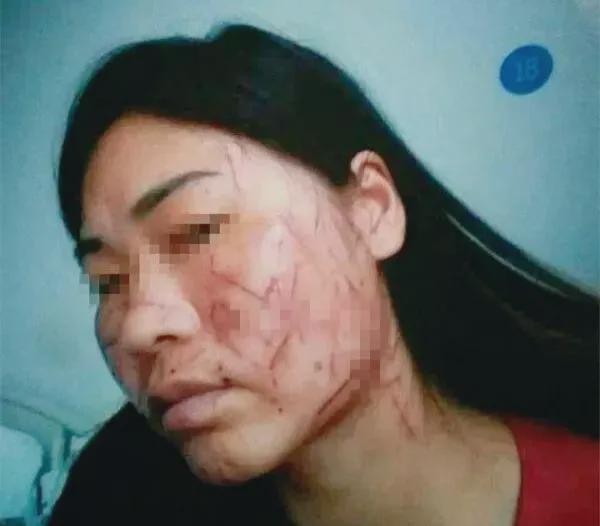 安徽女子被小三割脸百刀,毁容后还被亲生子女殴打,儿女:活该