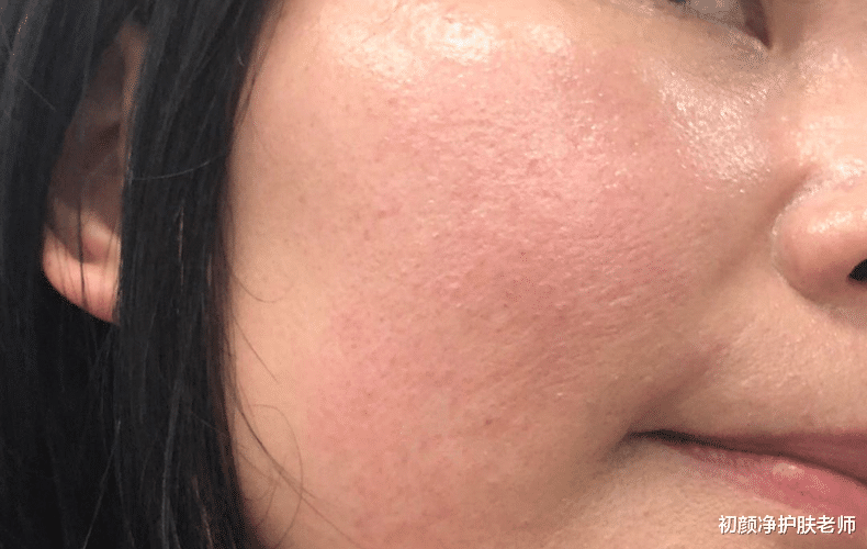 理肤泉 敏感肌用理肤泉,学会正确使用很重要!