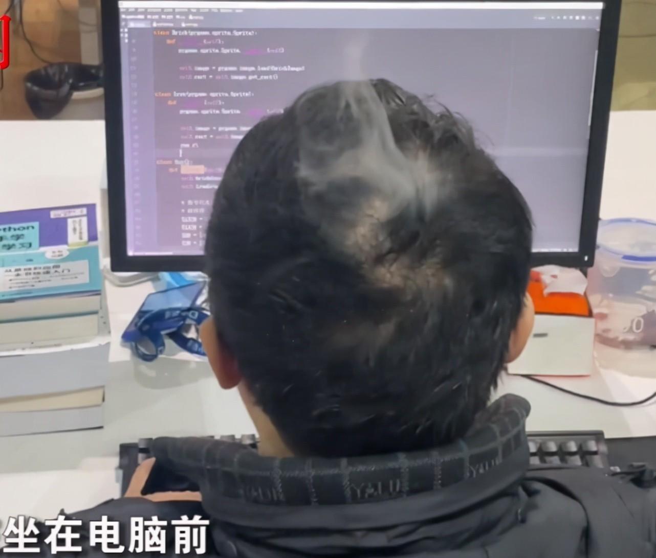 显示器|程序员写代码时头顶“冒烟”，认真工作毫无察觉，网友：太烧脑了