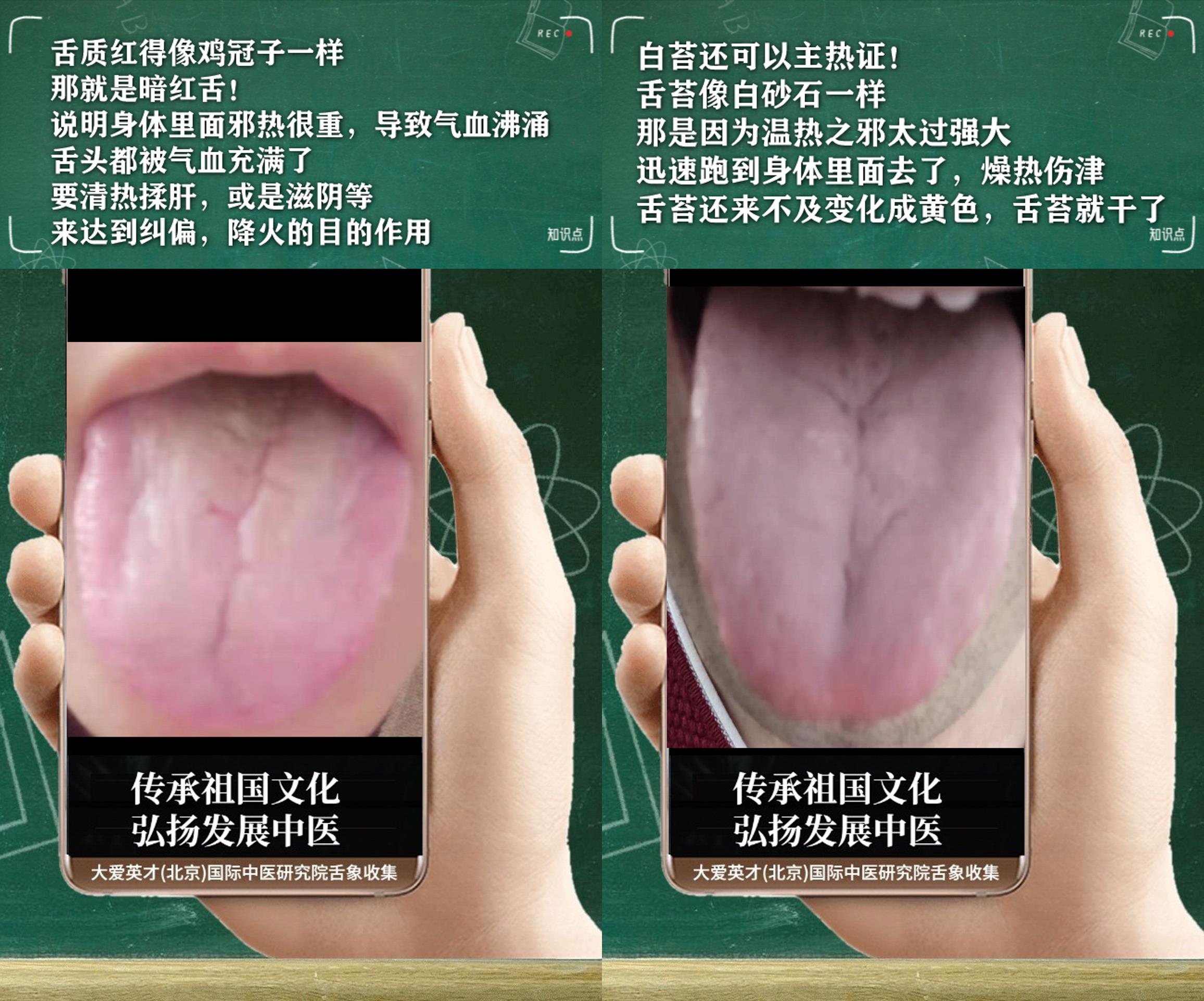 内分泌失调|中医医案:易愤怒、内分泌失调、慢性鼻炎、时好时差很影响生活