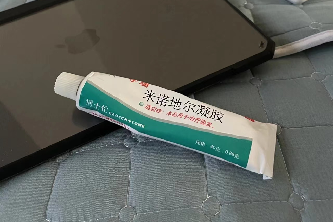 发饰 修饰发际线及鬓角的小脸秘诀,夏天扎马尾盘头发也不怕