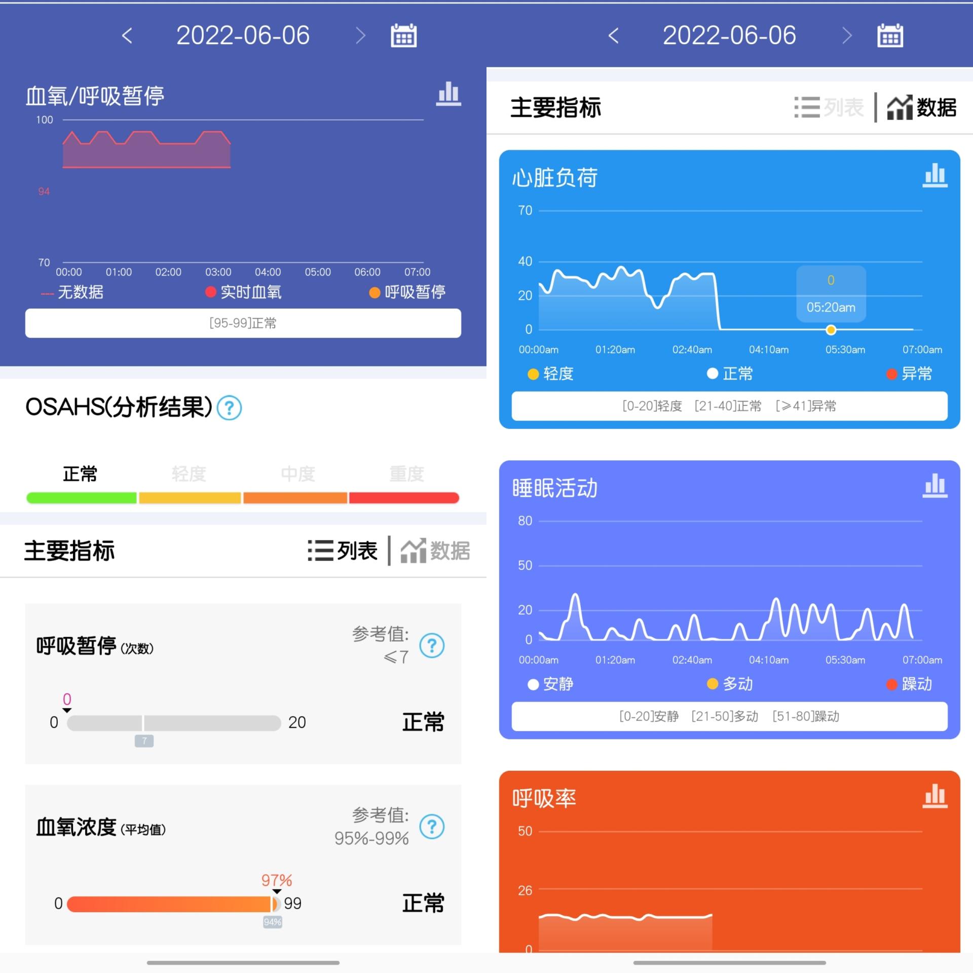 电信|智能手环的功能已经这么卷了吗？dido Y1健康手环全天测心电血压