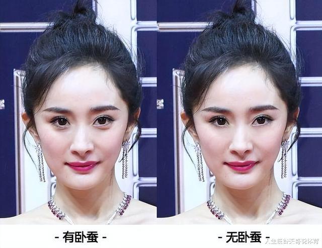 粉底 纪实：女子用臀部真皮做卧蚕，手术却意外失败，男友见后：好恶心