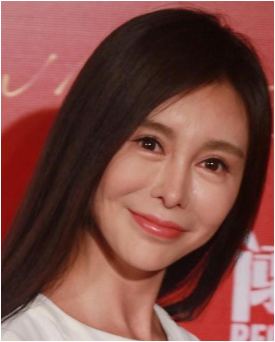 整容|7位被整容毁了的明星,有人美丽尽失事业滑坡,有人甚至赔了性命