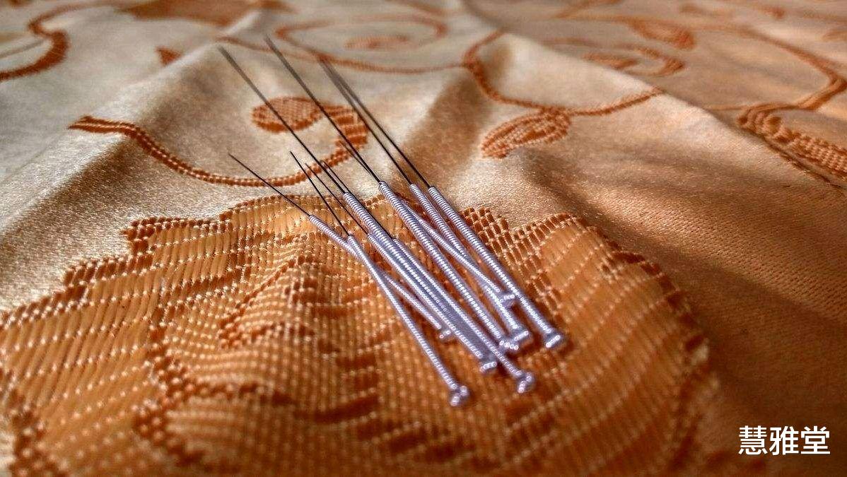 针灸|一根银针“征服”了很多人，中医董景昌创造性发展了中医针灸